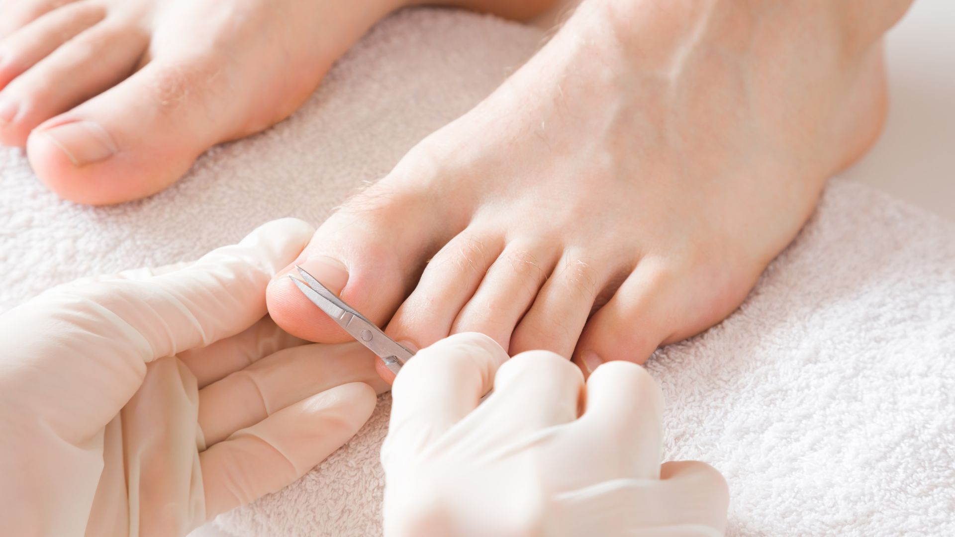 Mediostar laser epilazione Estetica Avanzata La Venere